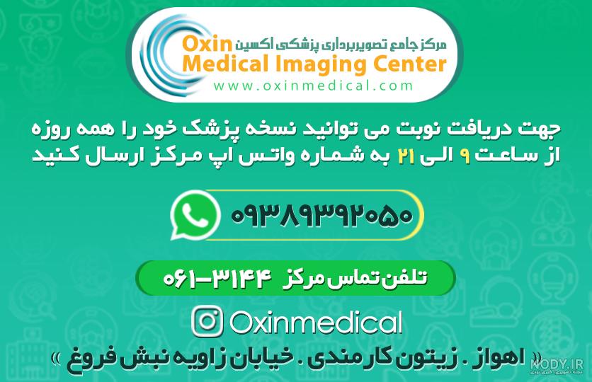 عکس برداری از چشم اهواز عکس برداری از چشم اهواز