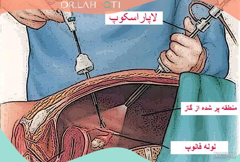 بارداری بعد از عکس رنگی رحم آیا امکان پذیر است؟ | نی نی پلاس