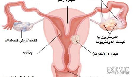 عوارض عکس رنگی از رحم/ عکس رنگی رحم چقدر درد داره؟!
