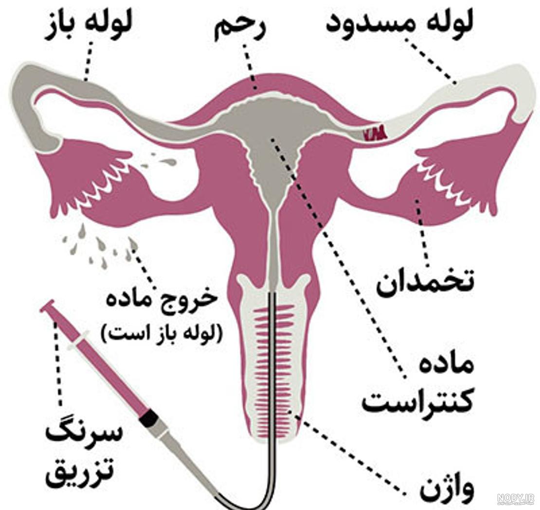 عکس رنگی رحم ناسالم نی نی سایت