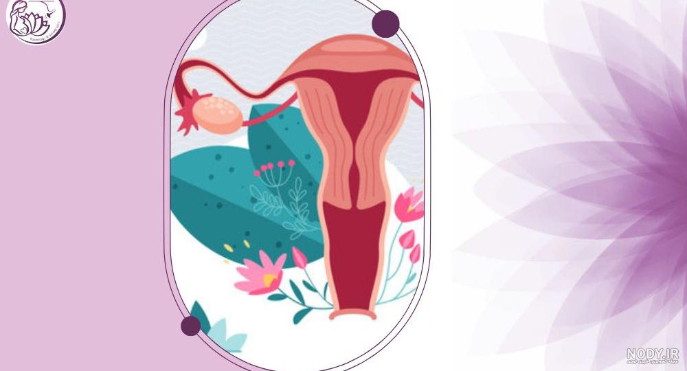 عکس رنگی رحم | هزینه هیستروسالپنگوگرافی رحم