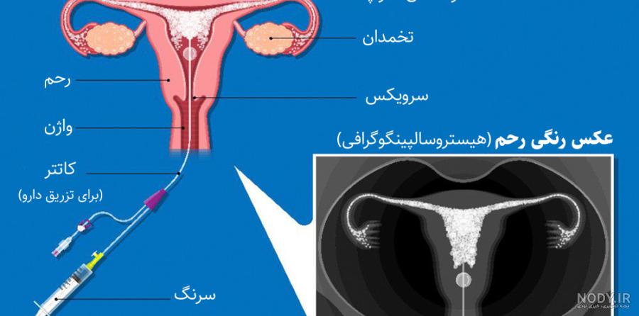 نرمال بودن عکس رنگی رحم