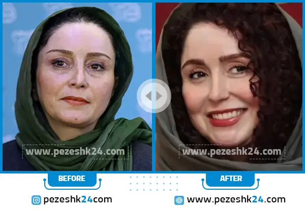 عکس دیدنی از ژاله صامتی و سام درخشانی در پشت صحنه / متفاوت تر از قبل ...
