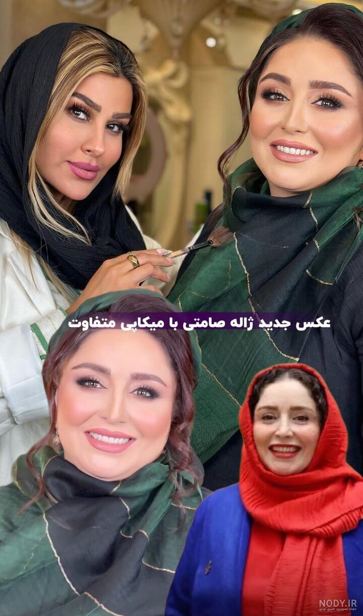 عکس ژاله صامتی قبل از عمل بینی