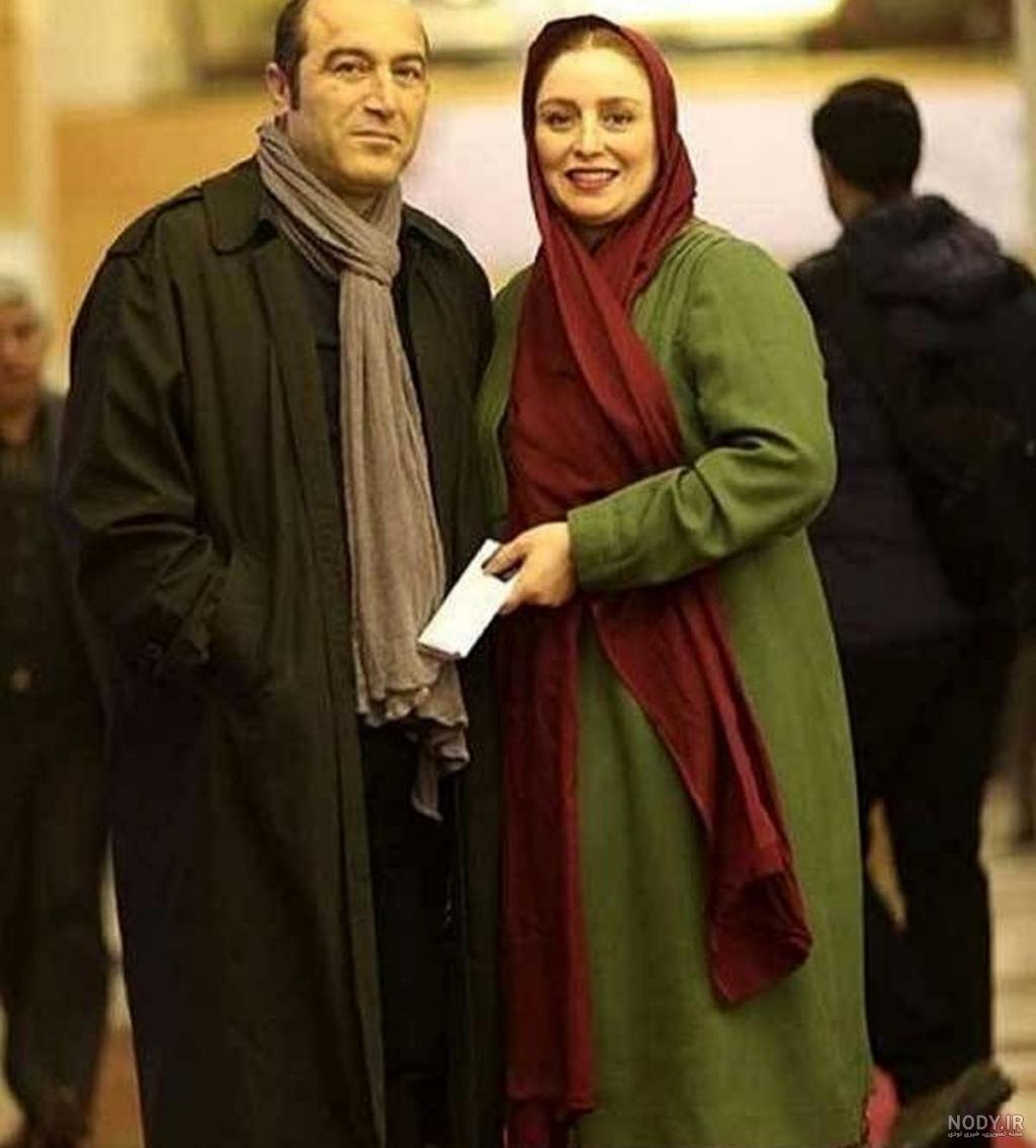 عکس ژاله صامتی قبل از عمل بینی - عکس نودی