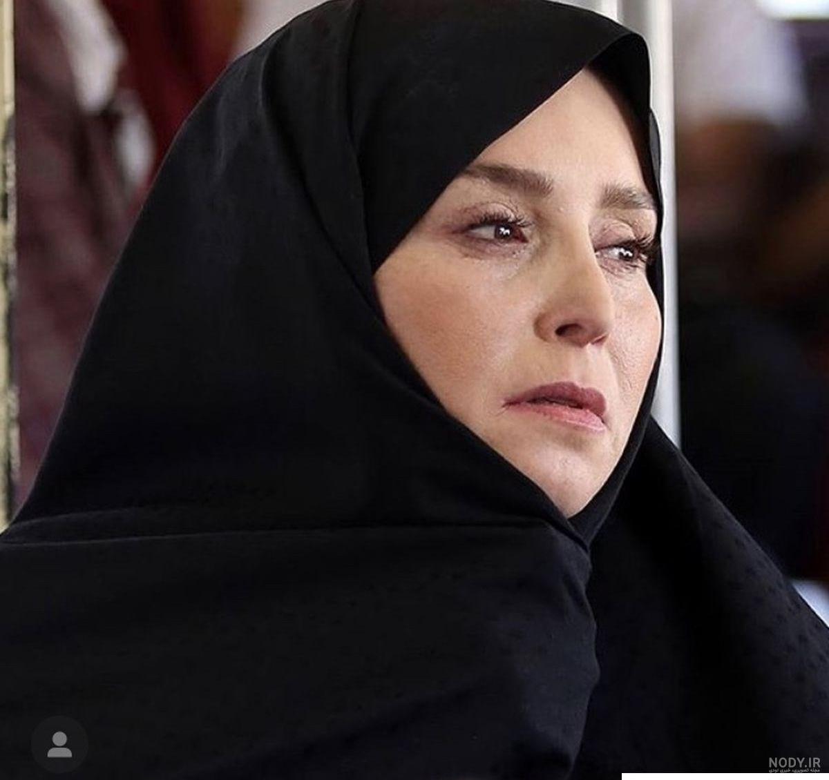 عکس ژاله صامتی قبل از عمل بینی - عکس نودی