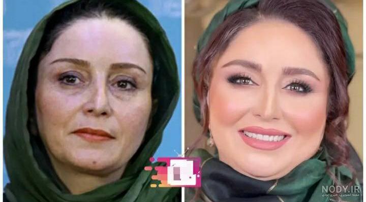 عکس ژاله صامتی قبل از عمل زیبایی - عکس نودی