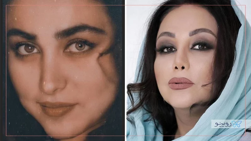 عکس های مورد دار ایرانی