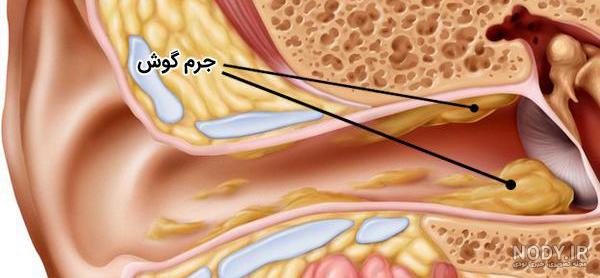 تحقیق در مورد گوش کلاس پنجم - تــــــــوپ تـــــــــاپ