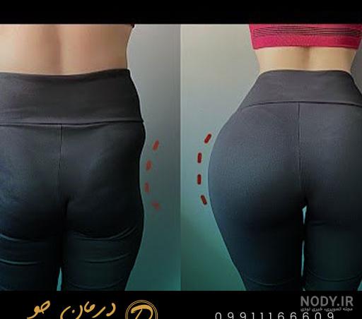 چکار کنم باسن اب میشه؟🥲 صفحه 15 | تبادل نظر نی نی سایت چکار کنم باسن اب میشه؟🥲 صفحه 15 | تبادل نظر نی نی سایت