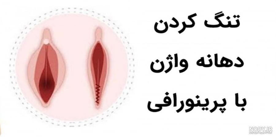 علت پارگی پرینه در رابطه چیست؟ [➕روش ترمیم پرینه] | دکتر مژده نامداری