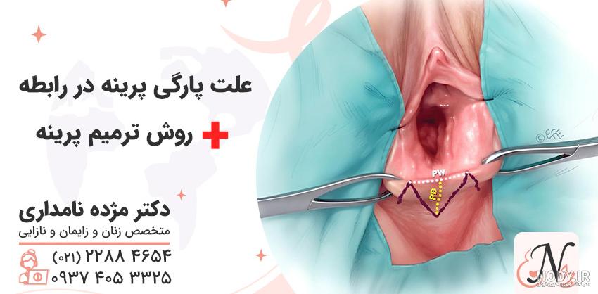 عکس پرینه واقعی مردان