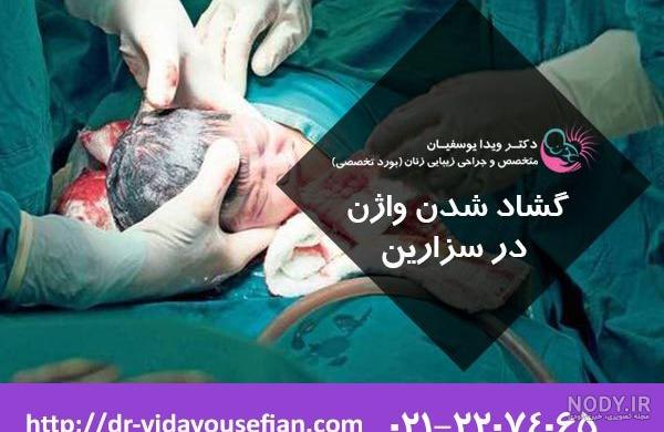 پرینه | ویکی آناتومی