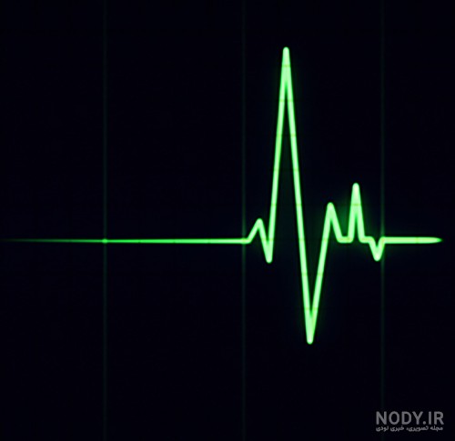 تصویر پروفایل ضربان قلب مشکی و عاشقانه، نماد عشق و احساس در سال 1404 و 2025 میلادی